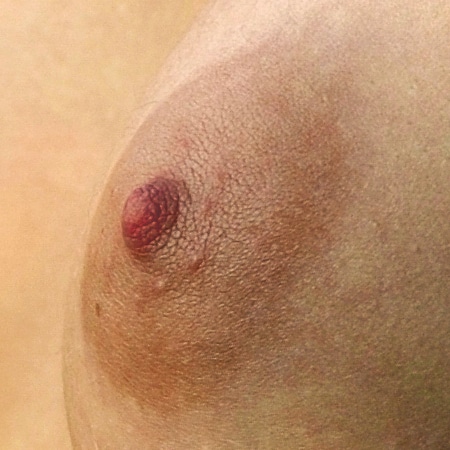 Nipple and areola Electric one -Wikipedia CC