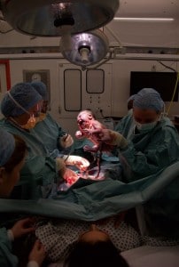 A photo of a Caesarean section birth