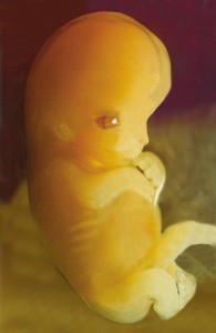 a photograph of a human embryo at 7 weeks after conception