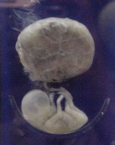 A human fetus, attached to placenta at 12 weeks