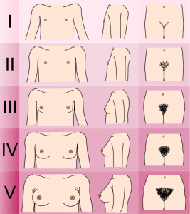 The Tanner Scale, a medical diagram showing the changes to a woman's body as a result of hormones and puberty